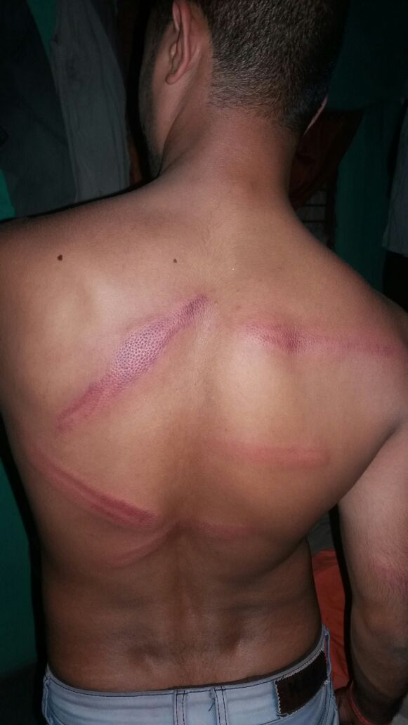 एसएसबी मेजर ने युवक को डंडों से पीटा - युवक को आयी गंभीर चोटे,