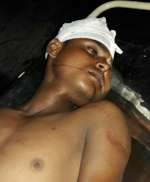 ट्रेन से कूदकर आत्म हत्या का प्रयास करने वाला युवक घायल-