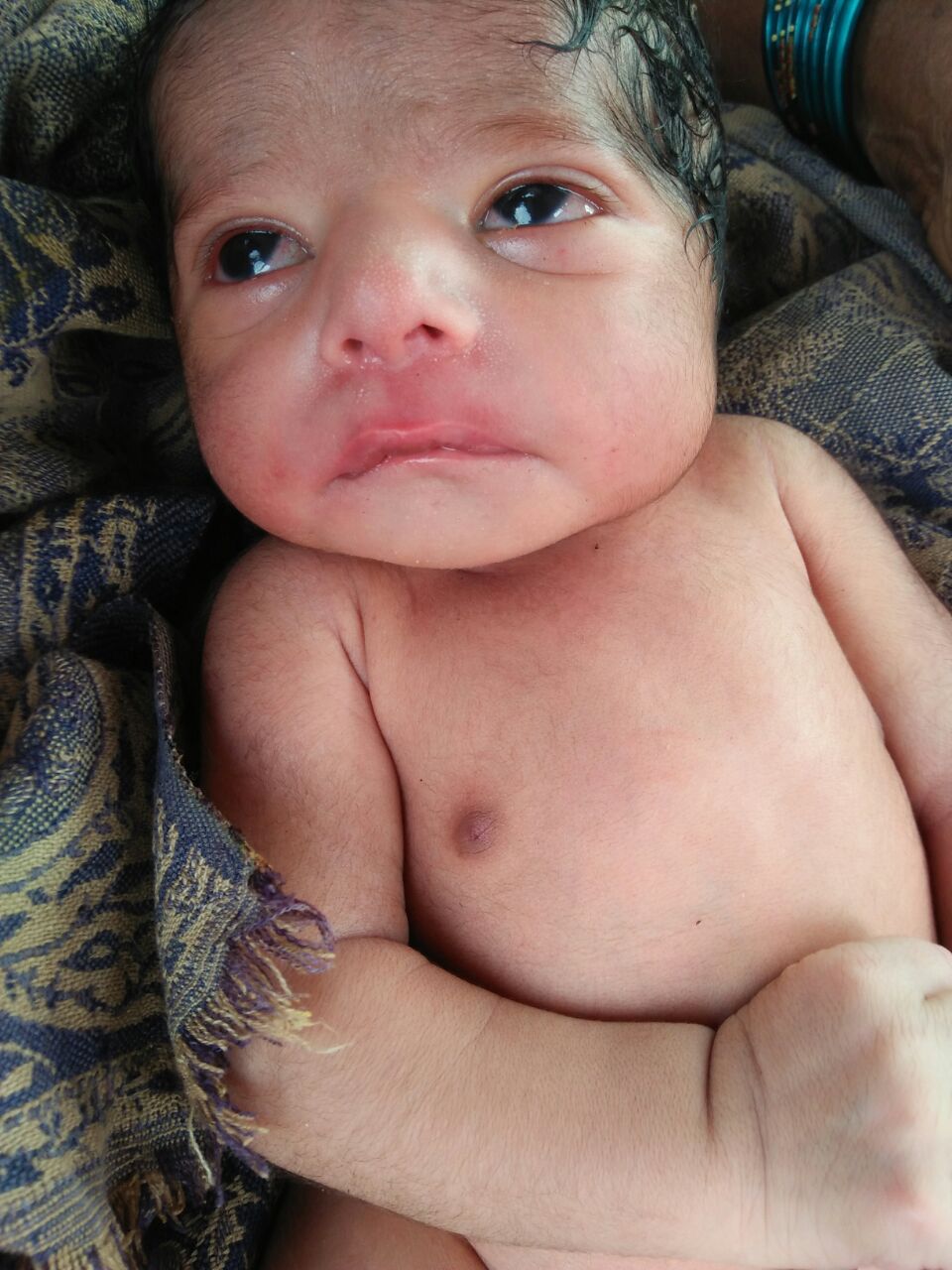 फरेंदा में अदभुद बच्चे का हुआ जन्म देखने वालों का लगा तांता