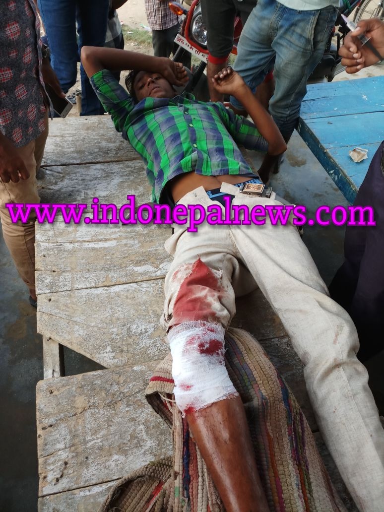 शराबी ट्रेक्टर चालक की लापरवाही से युवक का पैर कटा