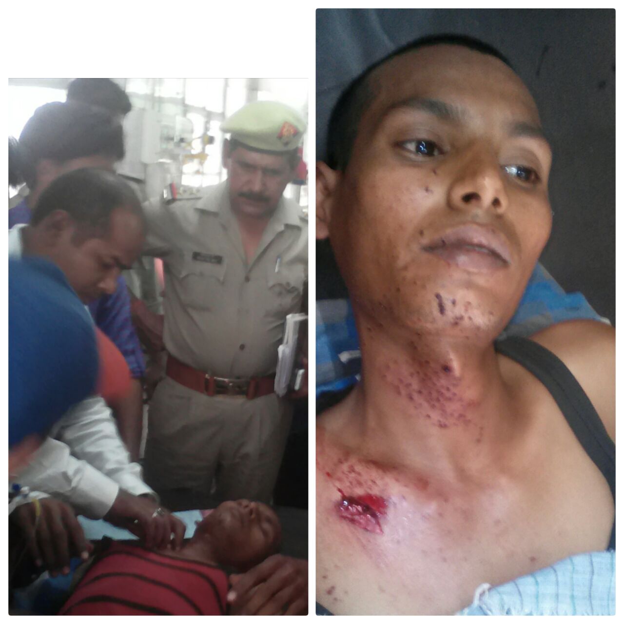 तमंचे की ट्राई में युवक को लगी गोली