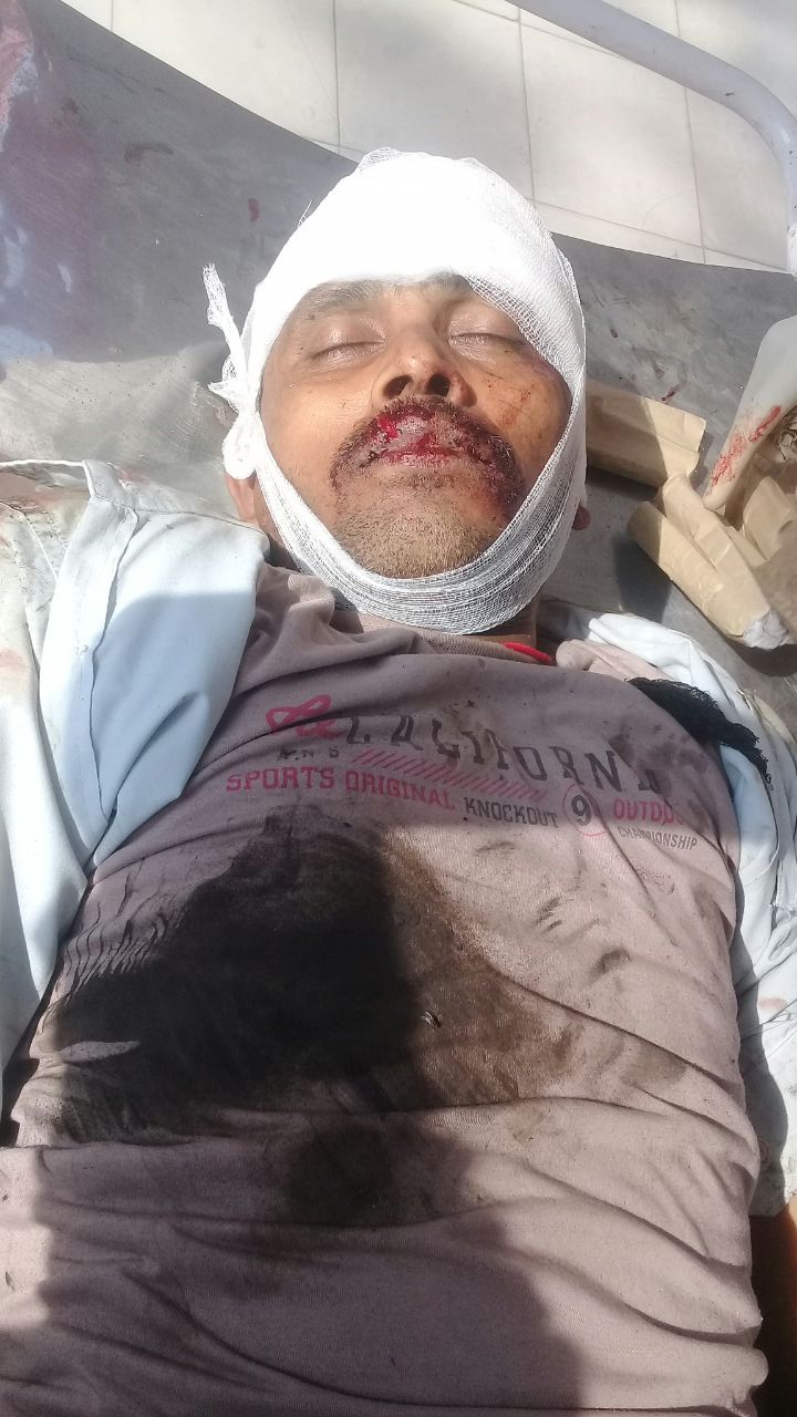 ट्रेन से गिरकर घायल व्यक्ति की मौत,जांच में जुटी पुलिस