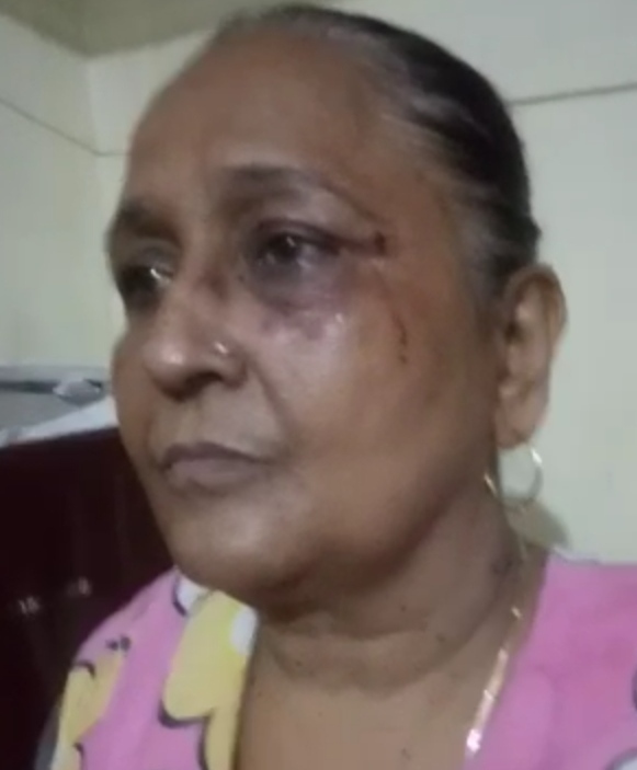 नौतनवा: शिक्षिका अफरोज जहां पर उनके पति और पुत्र ने किया हमला, हत्या का प्रयास