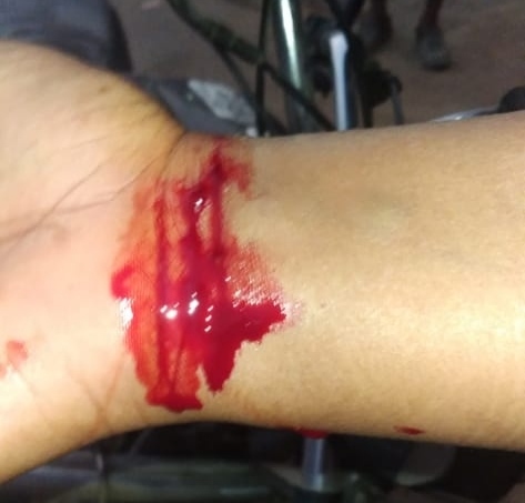 कोल्हुई --दबंग ने निरीह महिला को दौड़ा-दौड़ा कर चौराहे पर लाठियों से पीट कर किया अधमरा