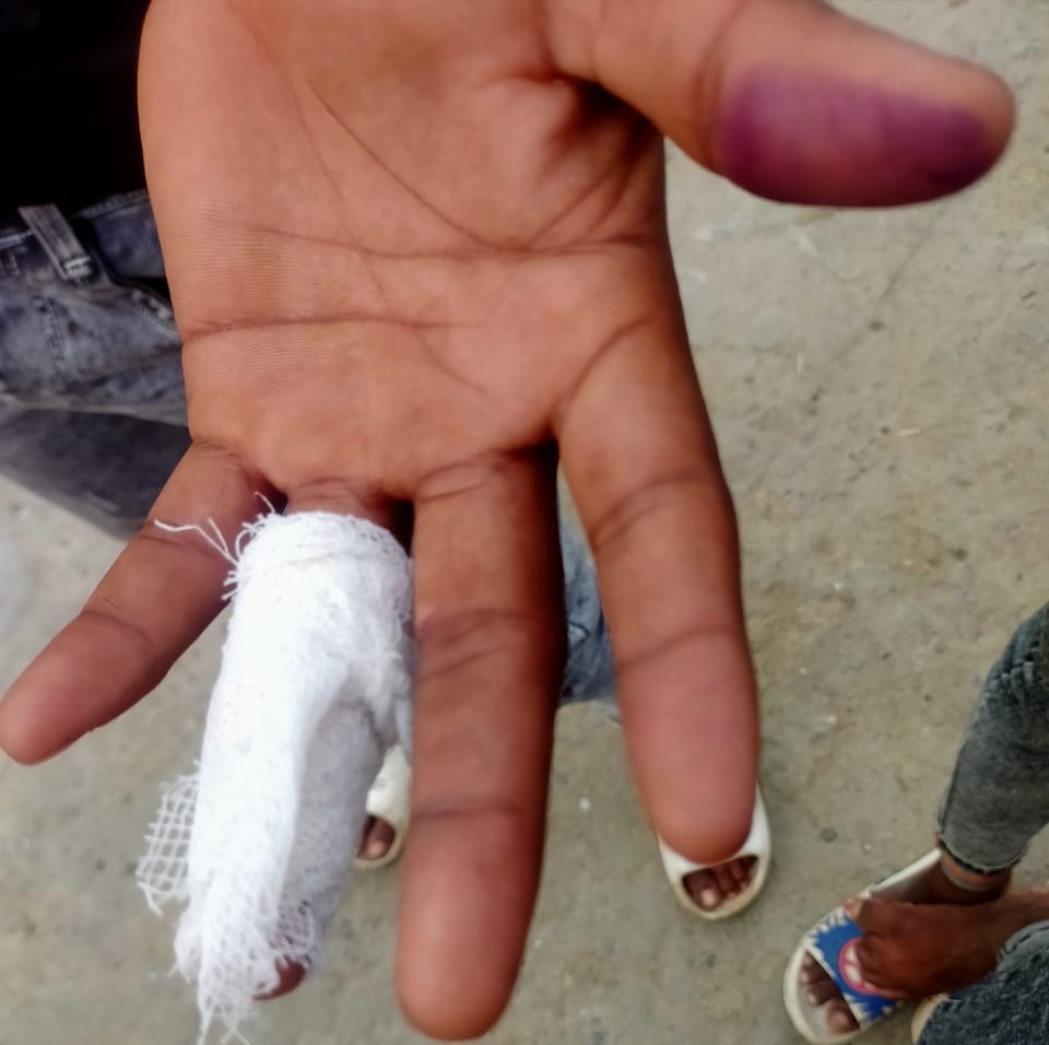 सोनौली: ताजिया ले जाते समय मोटरसाइकिल सवारों ने किया धारदार हथियार से हमला