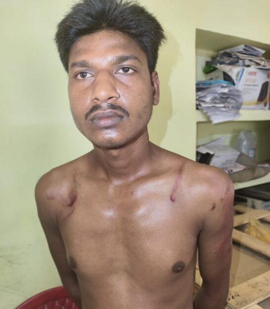 फरेंदा: युवक को जंगल में ले जाकर बेरहमी से पीटा, किया अमानवीय अत्याचार