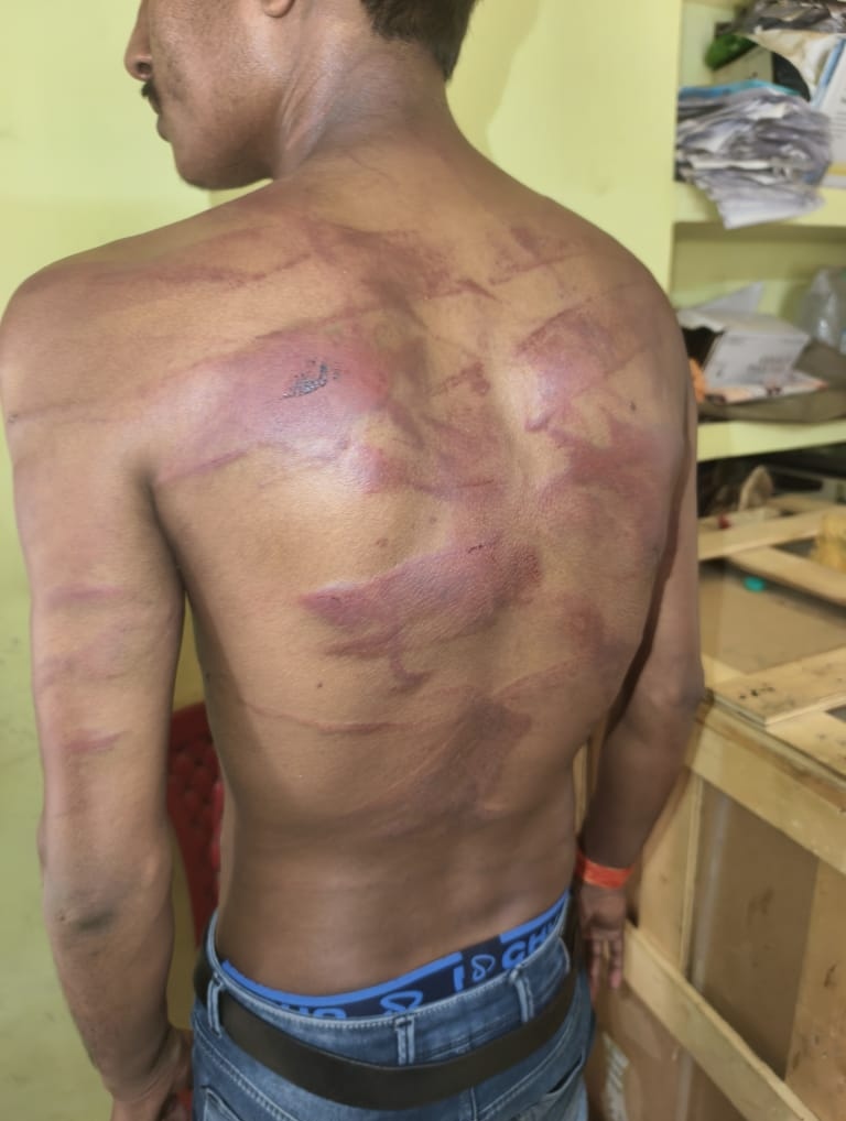 फरेंदा: युवक को जंगल में ले जाकर बेरहमी से पीटा, किया अमानवीय अत्याचार