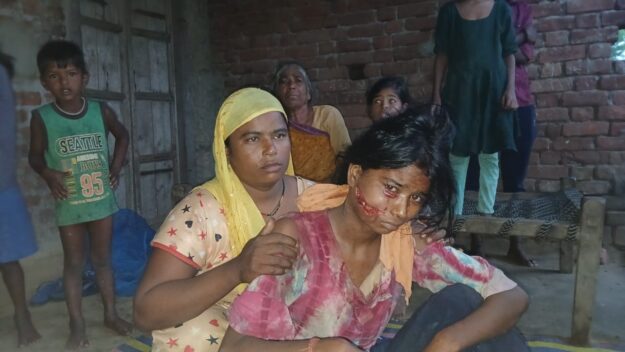 किशोरी पर तेंदुए का हमला,घायल किशोरी का मेडिकल कॉलेज में चल रहा इलाज